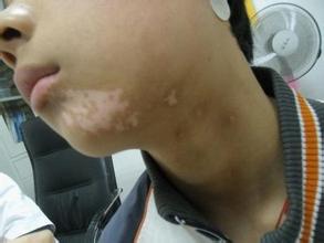 ����ע����������Щ��