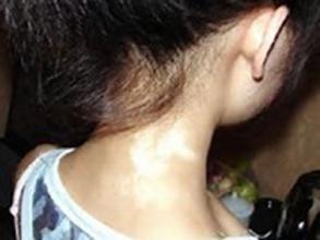 ��Щ֢״�ص��Ǿ����������ֳ���