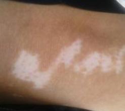 �����Ͱ���Ҫ������ЩԤ��������