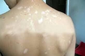 ���ڵİ����֢״������ʲô